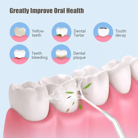 Portable Oral Irrigator